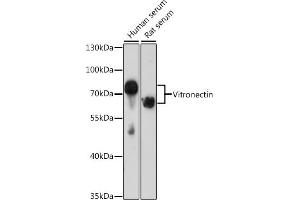 Western blot analysis of extracts of various cell lines, using Vitronectin antibody (ABIN3022357, ABIN3022358, ABIN3022359 and ABIN6218758) at 1:1000 dilution. (Vitronectin antibody  (AA 364-478))