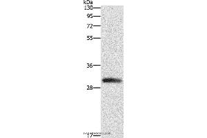 Western blot analysis of Mouse heart tissue, using DCK Polyclonal Antibody at dilution of 1:550 (DCK antibody)