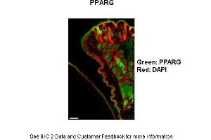 Immunohistochemistry (IHC) image for anti-Peroxisome Proliferator-Activated Receptor gamma (PPARG) (N-Term) antibody (ABIN2777645)