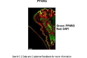 Mouse cornea and eyelid Primary Antibody Dilution: 1:100Secondary Antibody: Goat anti-rabbit-AlexaFluor-546 Secondary Antibody Dilution: 1:0000Color/Signal Descriptions: PPARG: Green DAPI: Red  Gene Name: Ppar Gamma  Submitted by: Anonymous