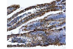 IHC analysis of VAPA using anti-VAPA antibody (ABIN7603249). (VAPA antibody  (N-Term))