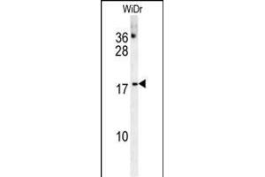 CHCHD2 Antibody (Center) (ABIN654013 and ABIN2843939) western blot analysis in WiDr cell line lysates (35 μg/lane). (CHCHD2 antibody  (AA 74-103))