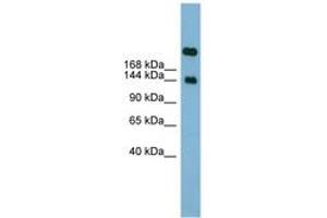 Image no. 1 for anti-Sucrase-Isomaltase (Alpha-Glucosidase) (SI) (AA 1691-1740) antibody (ABIN6742020) (Sucrase Isomaltase antibody  (AA 1691-1740))