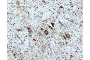 Rat cerebellum, formalin-fixed paraffin embedded tissue, with citrate pre-treatment, 20X. (Gephyrin antibody  (AA 569-726))