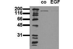 Western Blotting (WB) image for anti-Epidermal Growth Factor Receptor (EGFR) (Tyr1197) antibody (ABIN126780) (EGFR antibody  (Tyr1197))