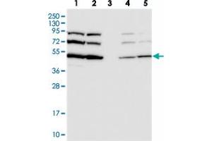 Western blot analysis of Lane 1: RT-4, Lane 2: U-251 MG, Lane 3: Human Plasma, Lane 4: Liver, Lane 5: Tonsil with SLC46A3 polyclonal antibody  at 1:250-1:500 dilution. (SLC46A3 antibody)