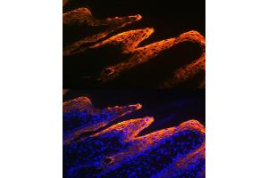 Immunofluorescence analysis of human skin using Cytokeratin 10 Rabbit mAb (ABIN1679404, ABIN3019133, ABIN3019134 and ABIN7101721) at dilution of 1:100 (40x lens). (Keratin 10 antibody)