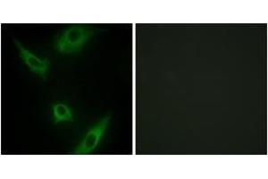 Immunofluorescence analysis of HeLa cells, using MAP3K1 Antibody. (MAP3K1 antibody  (AA 181-230))
