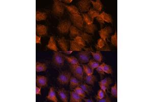 Immunofluorescence analysis of C6 cells using SCRN3 antibody (ABIN7270176) at dilution of 1:100. (Secernin 3 antibody  (AA 100-410))