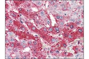 Immunohistochemistry: GLP2R antibody staining of Formalin-Fixed, Paraffin-Embedded Human Liver. (GLP2R antibody  (Extracellular Domain, N-Term))