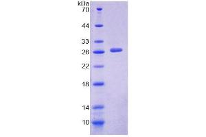 SDS-PAGE (SDS) image for Protein tyrosine Phosphatase, Non-Receptor Type 3 (PTPN3) (AA 704-906) protein (His tag) (ABIN6239493) (PTPN3 Protein (AA 704-906) (His tag))