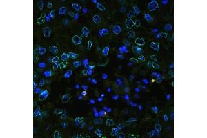 IF analysis of Emerin using anti-Emerin antibody (ABIN4886569). (Emerin antibody  (N-Term))