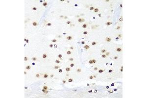 Immunohistochemistry of paraffin-embedded mouse brain using HTATSF1 antibody at dilution of 1:100 (40x lens).