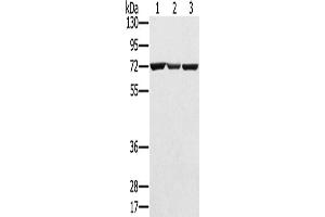 Western Blotting (WB) image for anti-Solute Carrier Family 25, Member 13 (Citrin) (slc25a13) antibody (ABIN2424163)