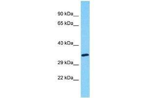 Western Blotting (WB) image for anti-Myeloid-Associated Differentiation Marker-Like 2 (MYADML2) (C-Term) antibody (ABIN2791681) (MYADML2 antibody  (C-Term))