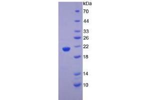 SDS-PAGE analysis of Human alpha Fodrin Protein. (SPTAN1 Protein)