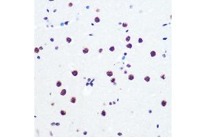 Immunohistochemistry of paraffin-embedded rat brain using P Rabbit mAb (ABIN7269445) at dilution of 1:100 (40x lens). (PABPN1 antibody)