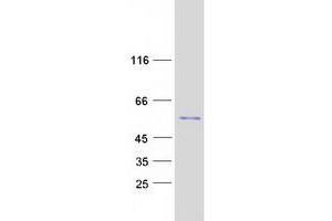 Validation with Western Blot
