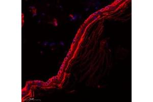 Immunofluorescence of paraffin embedded rat skin using Zdhhc9 (ABIN7076282) at dilution of 1: 700 (300x lens) (ZDHHC9 antibody)