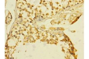Immunohistochemistry of paraffin-embedded human testis tissue using ABIN7172811 at dilution of 1:100 (TGFBR3 antibody  (AA 140-340))