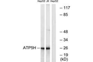 Western blot analysis of extracts from HepG2/Jurkat cells, using ATP5H Antibody. (ATP5H antibody  (AA 111-160))