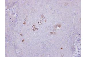 IHC-P Image Immunohistochemical analysis of paraffin-embedded Cal27 xenograft, using PHKA1, antibody at 1:500 dilution. (PHKA1 antibody  (C-Term))
