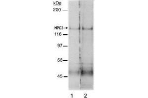 Western blot analysis of Npc1l1 in rat small intestine membrane preparations (Lane 1 : 2 ug/mL , Lane 2 : 4 ug/mL) with Npc1l1 polyclonal antibody . (NPC1L1 antibody  (AA 500-600))