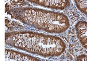 IHC-P Image Selenoprotein P antibody detects Selenoprotein P protein at cytoplasm in human colon by immunohistochemical analysis. (Selenoprotein P antibody)