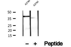 Western blot analysis of extracts of A2780 cells, using PRSS8 antibody.