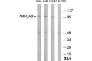 Western blot analysis of extracts from HuvEc/HeLa/A549 cells, using PNPLA8 Antibody. (PNPLA8 antibody  (AA 691-740))