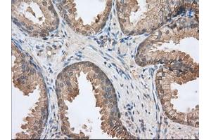 Immunohistochemical staining of paraffin-embedded Human Kidney tissue using anti-BSG mouse monoclonal antibody. (CD147 antibody)