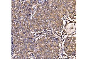 IHC analysis of SCRN1 using anti-SCRN1 antibody (ABIN7602923). (Secernin 1 antibody  (C-Term))