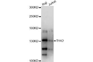 Western blot analysis of extracts of various cell lines, using TYK2 antibody (ABIN5971155) at 1/1000 dilution. (TYK2 antibody)