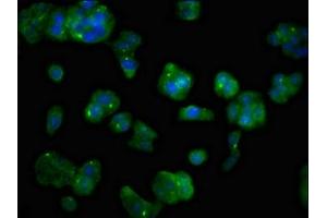 Immunofluorescent analysis of HepG2 cells using ABIN7159794 at dilution of 1:100 and Alexa Fluor 488-congugated AffiniPure Goat Anti-Rabbit IgG(H+L) (MAST3 antibody  (AA 1101-1309))