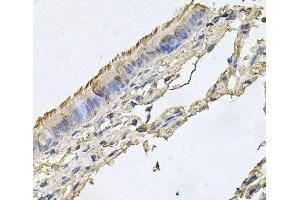 Immunohistochemistry of paraffin-embedded Human trachea using FABP12 Polyclonal Antibody at dilution of 1:100 (40x lens). (FABP12 antibody)