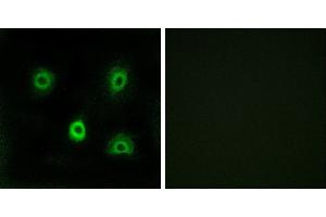 Peptide - +Western blot analysis of extracts from COLO cells, using ABHD6 antibody.