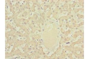 Immunohistochemistry of paraffin-embedded human liver tissue using ABIN7149326 at dilution of 1:100 (DYNC2LI1 antibody  (AA 1-352))