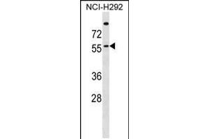 Western blot analysis in NCI-H292 cell line lysates (35ug/lane). (ZDHHC13 antibody  (N-Term))
