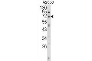 Western Blotting (WB) image for anti-Ewing Sarcoma Breakpoint Region 1 (EWSR1) antibody (ABIN3003929) (EWSR1 antibody)