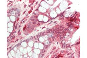 Anti-HDAC5 antibody IHC staining of human colon. (HDAC5 antibody  (AA 200-250))