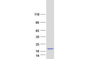 Validation with Western Blot