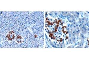 IHC testing of FFPE human pancreas with CCKAR antibody at 10ug/ml. (CCKAR antibody)