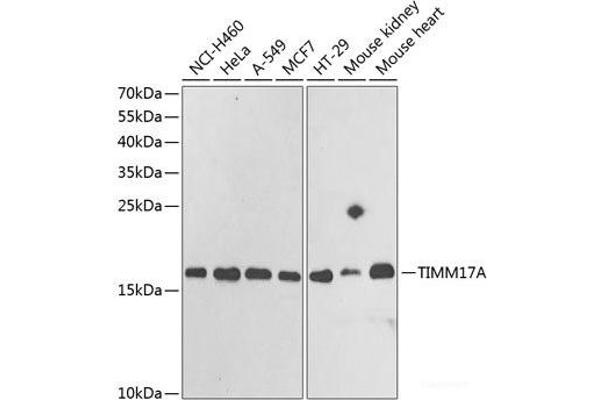 TIMM17A Antikörper