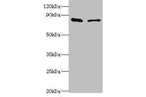 Western blot All lanes: SLC39A6 antibody at 10 μg/mL Lane 1: Hela whole cell lysate Lane 2: 293T whole cell lysate Secondary Goat polyclonal to rabbit IgG at 1/10000 dilution Predicted band size: 86, 49 kDa Observed band size: 86 kDa