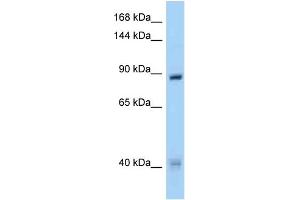 WB Suggested Anti-MUSK Antibody Titration: 1. (MUSK antibody  (N-Term))