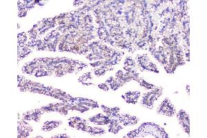 IHC analysis of EVA1A using anti-EVA1A antibody (ABIN6719564). (TMEM166 antibody)