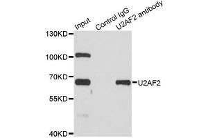 Immunoprecipitation analysis of 200ug extracts of SW620 cells using 1ug U2AF2 antibody. (U2AF2 antibody)