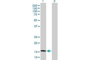 Western Blot analysis of SAT2 expression in transfected 293T cell line by SAT2 MaxPab polyclonal antibody. (SAT2 antibody  (AA 1-170))