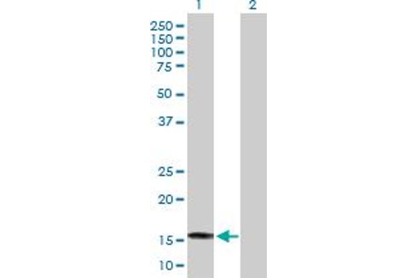 SAT2 anticorps  (AA 1-170)
