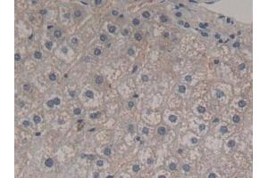 Detection of FGF12 in Human Liver Tissue using Polyclonal Antibody to Fibroblast Growth Factor 12 (FGF12)